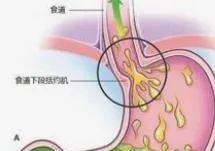 天博体育官方平台入口50厘米的管子直插体内现在的人都这么减肥？(图14)