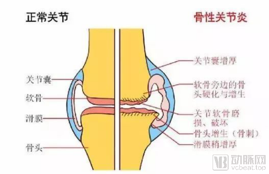 天博聚乙烯材料什么是聚乙烯材料？聚乙烯材料的最新报道(图4)